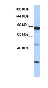 TDRD9 / HIG-1 Antibody - TDRD9 antibody Western blot of 721_B cell lysate. This image was taken for the unconjugated form of this product. Other forms have not been tested.