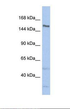 TDRD9 / HIG-1 Antibody - Western blot of Human ACHN. TDRD9 antibody dilution 1.0 ug/ml.  This image was taken for the unconjugated form of this product. Other forms have not been tested.