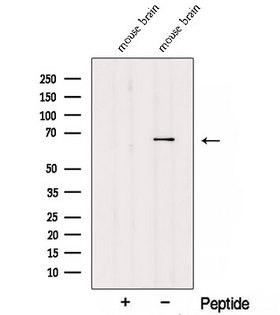 TDRKH Antibody - Western blot analysis of extracts of HeLa cells using TDRKHspecific antibody. The lane on the left was treated with blocking peptide.