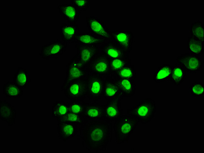 TEAD1 Antibody - Immunofluorescence staining of A549 cells with TEAD1 Antibody at 1:147, counter-stained with DAPI. The cells were fixed in 4% formaldehyde, permeabilized using 0.2% Triton X-100 and blocked in 10% normal Goat Serum. The cells were then incubated with the antibody overnight at 4°C. The secondary antibody was Alexa Fluor 488-congugated AffiniPure Goat Anti-Rabbit IgG(H+L).