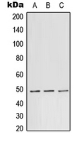 TEAD1 Antibody - Western blot analysis of TEAD1 expression in A431 (A); Raw264.7 (B); PC12 (C) whole cell lysates.