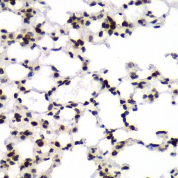 TEAD1 Antibody - Immunohistochemistry of paraffin-embedded mouse lung tissue.