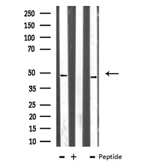 TEAD1 Antibody - Western blot analysis of extracts of COLO205/K562 cells using TEAD1 antibody.