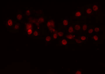 TEAD1 Antibody - Staining COLO205 cells by IF/ICC. The samples were fixed with PFA and permeabilized in 0.1% Triton X-100, then blocked in 10% serum for 45 min at 25°C. The primary antibody was diluted at 1:200 and incubated with the sample for 1 hour at 37°C. An Alexa Fluor 594 conjugated goat anti-rabbit IgG (H+L) antibody, diluted at 1/600, was used as secondary antibody.