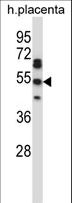 TEAD2 Antibody - TEAD2 Antibody western blot of human placenta tissue lysates (35 ug/lane). The TEAD2 antibody detected the TEAD2 protein (arrow).
