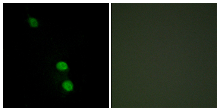 TEAD2 Antibody - Immunofluorescence analysis of HepG2 cells, using TEAD2 Antibody. The picture on the right is blocked with the synthesized peptide.
