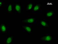 TEAD2 Antibody - Immunostaining analysis in HeLa cells. HeLa cells were fixed with 4% paraformaldehyde and permeabilized with 0.1% Triton X-100 in PBS. The cells were immunostained with anti-TEAD2 mAb.