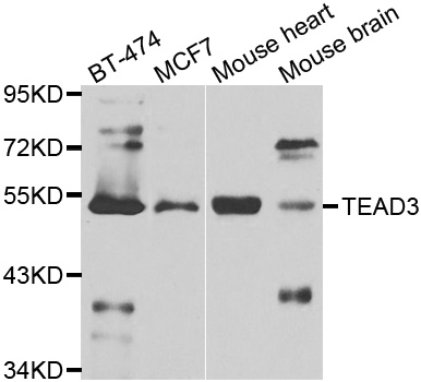 TEAD3 Antibody - Western blot analysis of extracts of various cell lines.