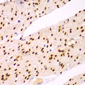 TEAD3 Antibody - Immunohistochemistry of paraffin-embedded human colon tissue.