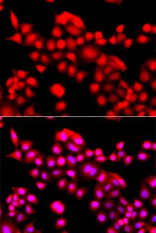TEAD3 Antibody - Immunofluorescence analysis of A549 cells.
