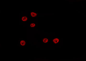 TEAD3 Antibody - Staining HeLa cells by IF/ICC. The samples were fixed with PFA and permeabilized in 0.1% Triton X-100, then blocked in 10% serum for 45 min at 25°C. The primary antibody was diluted at 1:200 and incubated with the sample for 1 hour at 37°C. An Alexa Fluor 594 conjugated goat anti-rabbit IgG (H+L) Ab, diluted at 1/600, was used as the secondary antibody.