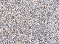 TEAD3 Antibody - Immunohistochemistry of paraffin-embedded Human tonsil tissue  using TEAD3 Polyclonal Antibody at dilution of 1:50(×200)