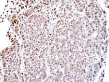 TEAD4 Antibody - IHC of paraffin-embedded SW480 xenograft using TEAD4 antibody at 1:500 dilution.