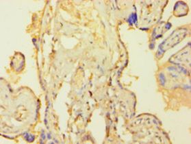 TEAD4 Antibody - Immunohistochemistry of paraffin-embedded human placenta tissue using antibody at 1:100 dilution.  This image was taken for the unconjugated form of this product. Other forms have not been tested.