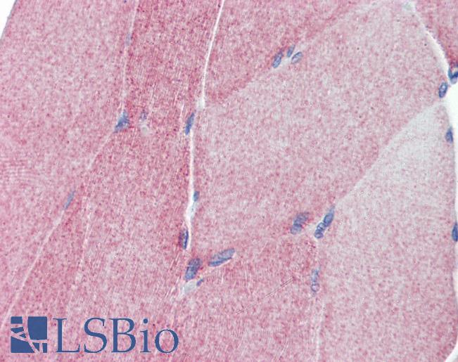 TEAD4 Antibody - Anti-TEAD4 antibody IHC of human skeletal muscle. Immunohistochemistry of formalin-fixed, paraffin-embedded tissue after heat-induced antigen retrieval. Antibody concentration 5 ug/ml.  This image was taken for the unconjugated form of this product. Other forms have not been tested.