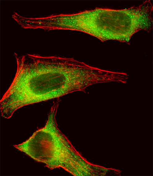 TEC Antibody - Fluorescent image of HeLa cell stained with TEC Antibody. HeLa cells were fixed with 4% PFA (20 min), permeabilized with Triton X-100 (0.1%, 10 min), then incubated with TEC primary antibody (1:25, 1 h at 37°C). For secondary antibody, Alexa Fluor 488 conjugated donkey anti-rabbit antibody (green) was used (1:400, 50 min at 37°C). Cytoplasmic actin was counterstained with Alexa Fluor 555 (red) conjugated Phalloidin (7units/ml, 1 h at 37°C). TEC immunoreactivity is localized to Cytoplasm significantly.