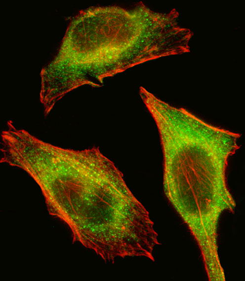 TEC Antibody - Fluorescent image of HeLa cell stained with TEC Antibody. HeLa cells were fixed with 4% PFA (20 min), permeabilized with Triton X-100 (0.1%, 10 min), then incubated with TEC primary antibody (1:25, 1 h at 37°C). For secondary antibody, Alexa Fluor 488 conjugated donkey anti-rabbit antibody (green) was used (1:400, 50 min at 37°C). Cytoplasmic actin was counterstained with Alexa Fluor 555 (red) conjugated Phalloidin (7units/ml, 1 h at 37°C). TEC immunoreactivity is localized to Cytoplasm significantly.