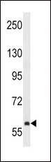 TEC Antibody - TEC Antibody (F190) western blot of NCI-H292 cell line lysates (35 ug/lane). The TEC antibody detected the TEC protein (arrow).