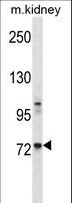 TEC Antibody - Mouse Tec Antibody western blot of mouse kidney tissue lysates (35 ug/lane). The Tec antibody detected the Tec protein (arrow).