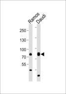 TEC Antibody - Western blot of lysates from Ramos, Daudi cell line (from left to right), using TEC antibody diluted at 1:1000 at each lane. A goat anti-rabbit IgG H&L (HRP) at 1:10000 dilution was used as the secondary antibody. Lysates at 20 ug per lane.