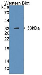 TEC Antibody - Western blot of TEC antibody.