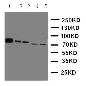 TEC Antibody - WB of TEC antibody. Lane 1: Rat Liver Tissue Lysate. Lane 2: Rat Spleen Tissue Lysate. Lane 3: Rat Kidney Tissue Lysate. Lane 4: HELA Cell Lysate. Lane 5: JURKAT Cell Lysate.