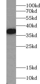 TEC Antibody - Recombinant protein (90-240aa) were subjected to SDS PAGE followed by western blot with Tec antibody at dilution of 1:1000