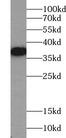 TEC Antibody - Recombinant protein (90-240aa) were subjected to SDS PAGE followed by western blot with Tec antibody at dilution of 1:1000