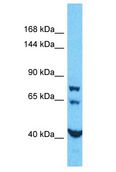 TECPR1 Antibody - TECPR1 antibody Western Blot of HepG2. Antibody dilution: 1 ug/ml.  This image was taken for the unconjugated form of this product. Other forms have not been tested.