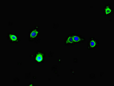 TECPR1 Antibody - Immunofluorescent analysis of A375 cells diluted at 1:100 and Alexa Fluor 488-congugated AffiniPure Goat Anti-Rabbit IgG(H+L)