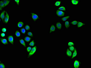 TECPR2 Antibody - Immunofluorescent analysis of PC3 cells using TECPR2 Antibody at a dilution of 1:100 and Alexa Fluor 488-congugated AffiniPure Goat Anti-Rabbit IgG(H+L)