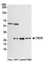 TECR / TER Antibody - Detection of human and mouse TECR by western blot. Samples: Whole cell lysate (15 µg) from HeLa, HEK293T, Jurkat, and mouse TCMK-1, cells prepared using NETN lysis buffer. Antibody: Affinity purified rabbit anti-TECR antibody used for WB at 0.1 µg/ml. Detection: Chemiluminescence with an exposure time of 3 minutes.