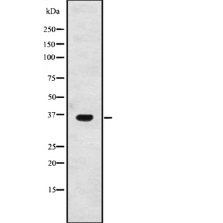 TECR / TER Antibody - Western blot analysis of GPSN2 expression in A2058 cells lysate. The lane on the left is treated with the antigen-specific peptide.