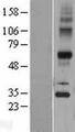TECR / TER Protein - Western validation with an anti-DDK antibody * L: Control HEK293 lysate R: Over-expression lysate
