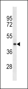 TECRL Antibody - SRD5A2L2 Antibody (Ascites)western blot of A549 cell line lysates (35 ug/lane). The SRD5A2L2 antibody detected the SRD5A2L2 protein (arrow).