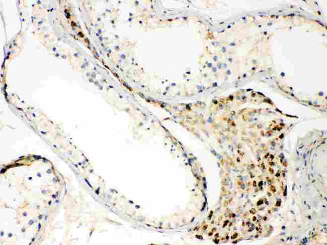 TECTA Antibody - TECTA was detected in paraffin-embedded sections of human testis tissues using rabbit anti- TECTA Antigen Affinity purified polyclonal antibody