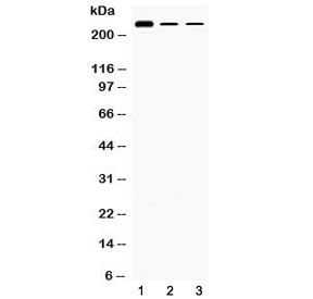 TECTA Antibody - Western blot testing of 1) rat testis, 2) mouse Hepa1-6 and 3) human HepG2 lysate with TECTA antibody at 0.5ug/ml. Predicted molecular weight: ~240 kDa.