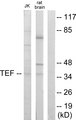 TEF Antibody - Western blot analysis of lysates from Jurkat and rat brain cells, using TEF Antibody. The lane on the right is blocked with the synthesized peptide.
