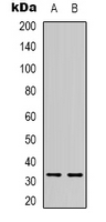 TEF Antibody - Western blot analysis of TEF expression in Jurkat (A); mouse liver (B) whole cell lysates.