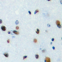 TEF Antibody - Immunohistochemical analysis of TEF staining in human brain formalin fixed paraffin embedded tissue section. The section was pre-treated using heat mediated antigen retrieval with sodium citrate buffer (pH 6.0). The section was then incubated with the antibody at room temperature and detected with HRP and DAB as chromogen. The section was then counterstained with hematoxylin and mounted with DPX.