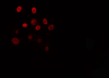 TEF Antibody - Staining HeLa cells by IF/ICC. The samples were fixed with PFA and permeabilized in 0.1% Triton X-100, then blocked in 10% serum for 45 min at 25°C. The primary antibody was diluted at 1:200 and incubated with the sample for 1 hour at 37°C. An Alexa Fluor 594 conjugated goat anti-rabbit IgG (H+L) antibody, diluted at 1/600, was used as secondary antibody.