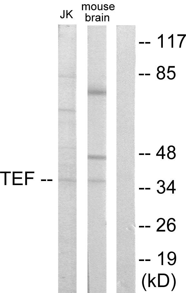 TEF Antibody - Western blot analysis of extracts from Jurkat cells and mouse brain cells, using TEF antibody.