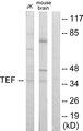 TEF Antibody - Western blot analysis of extracts from Jurkat cells and mouse brain cells, using TEF antibody.