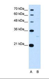 TEF Antibody - Lane A: Marker. Lane B: HepG2 cell lysate. Antibody concentration: 1.0 ug/ml. Gel concentration: 12%.  This image was taken for the unconjugated form of this product. Other forms have not been tested.