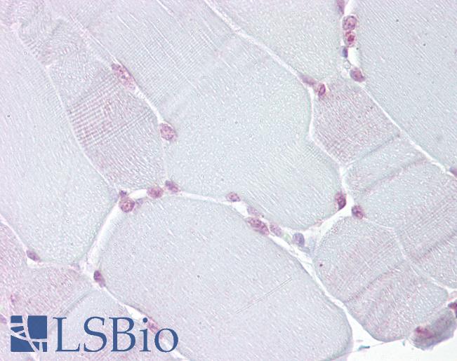 TEF Antibody - Anti-TEF antibody IHC of human skeletal muscle. Immunohistochemistry of formalin-fixed, paraffin-embedded tissue after heat-induced antigen retrieval. Antibody concentration 5 ug/ml.  This image was taken for the unconjugated form of this product. Other forms have not been tested.