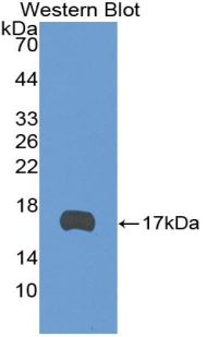 TEK / TIE2 Antibody - Western blot of recombinant TEK / TIE2.