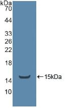 TEK / TIE2 Antibody - Western Blot; Sample: Recombinant ADRbK1, Human.