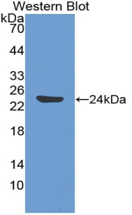 TEK / TIE2 Antibody - Western blot of recombinant TEK / TIE2.