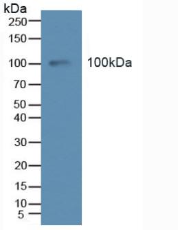 TEK / TIE2 Antibody - Western Blot; Sample: Human Serum.