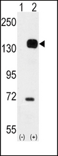 TEK / TIE2 Antibody - Western blot of TEK (arrow) using rabbit polyclonal TEK Antibody. 293 cell lysates (2 ug/lane) either nontransfected (Lane 1) or transiently transfected with the TEK gene (Lane 2) (Origene Technologies).